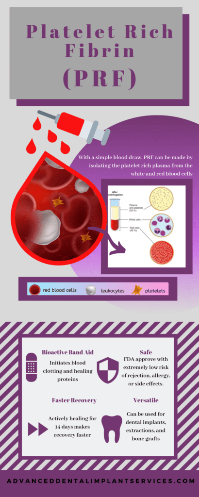 Platelet Rich Fibrin Infographic